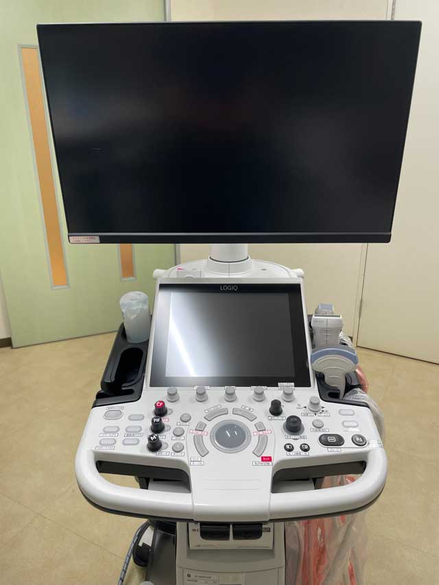 腹部超音波検査とは